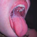 mouth.kink
